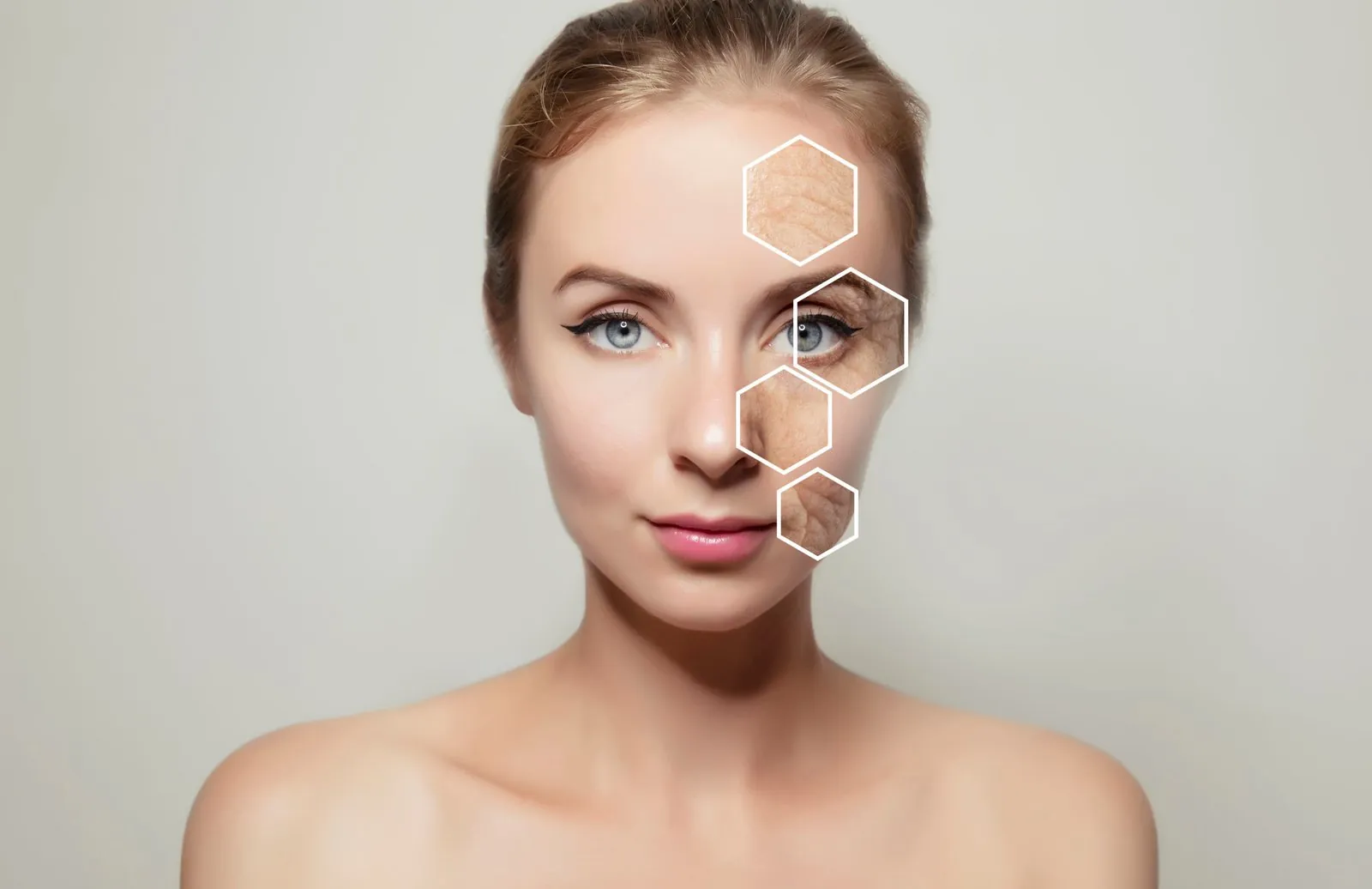 Woman's face with highlighted areas of skin texture, illustrating concerns Morpheus8 can treat